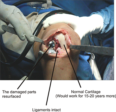 Perfectly done oxford knee 2